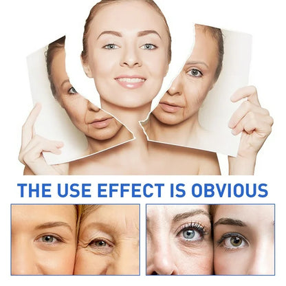 2xBotox Stock Solution suero antiarruga 2 por 1