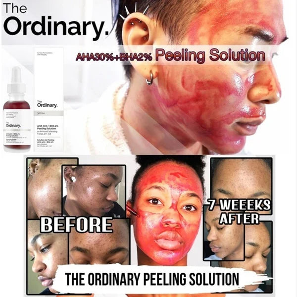 💖Peeling The Ordinary®🩸